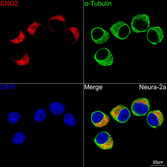 NSE Antibody in Immunocytochemistry (ICC/IF)