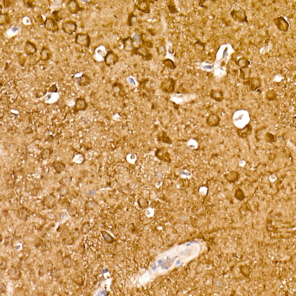 NSE Antibody in Immunohistochemistry (Paraffin) (IHC (P))