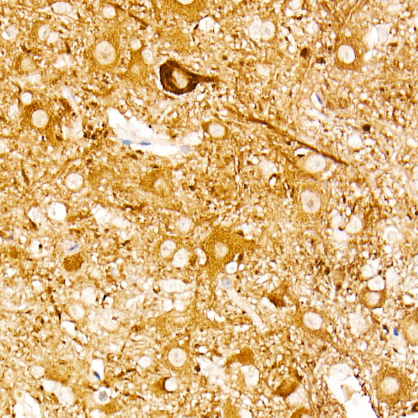 NSE Antibody in Immunohistochemistry (Paraffin) (IHC (P))