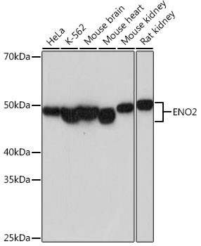 NSE Antibody in Western Blot (WB)