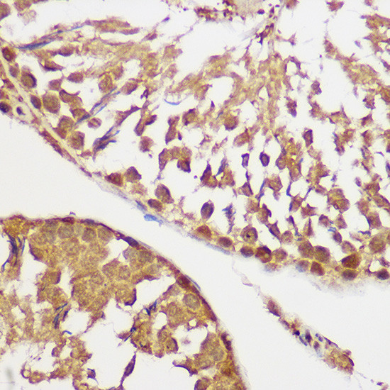 AKT Pan Antibody in Immunohistochemistry (Paraffin) (IHC (P))