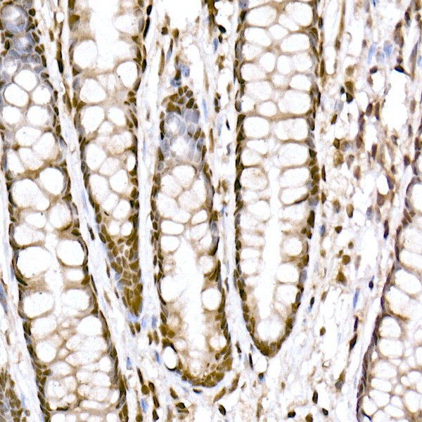 PRDM9 Antibody in Immunohistochemistry (Paraffin) (IHC (P))