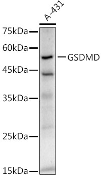 GSDMD Antibody in Western Blot (WB)