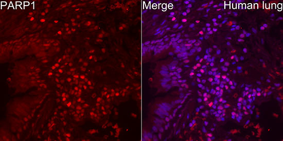 PARP1 Antibody in Immunocytochemistry (ICC/IF)