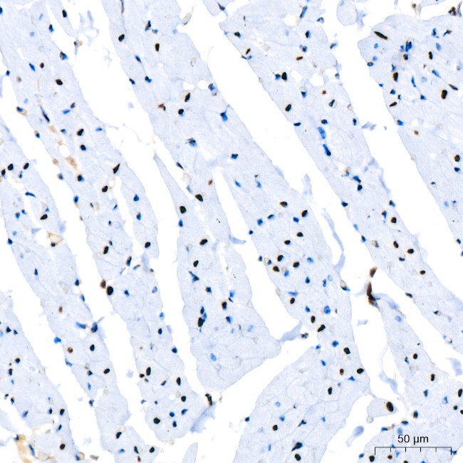 PARP1 Antibody in Immunohistochemistry (Paraffin) (IHC (P))