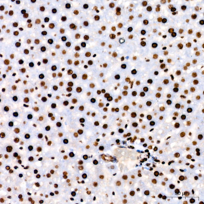 PARP1 Antibody in Immunohistochemistry (Paraffin) (IHC (P))