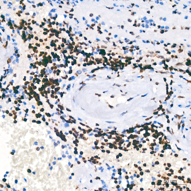 PARP1 Antibody in Immunohistochemistry (Paraffin) (IHC (P))