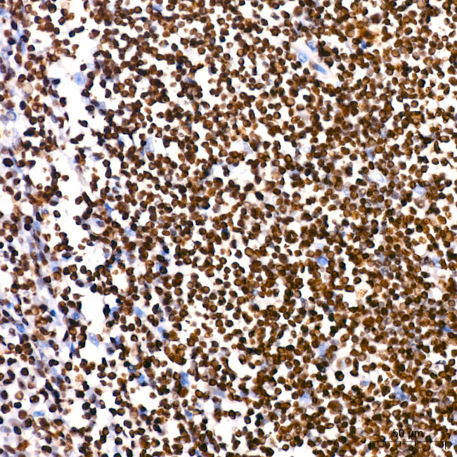 PARP1 Antibody in Immunohistochemistry (Paraffin) (IHC (P))