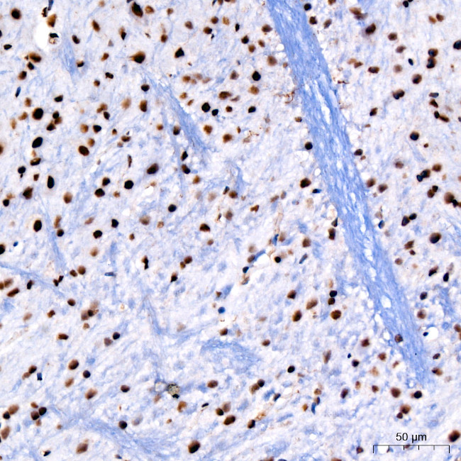 PARP1 Antibody in Immunohistochemistry (Paraffin) (IHC (P))