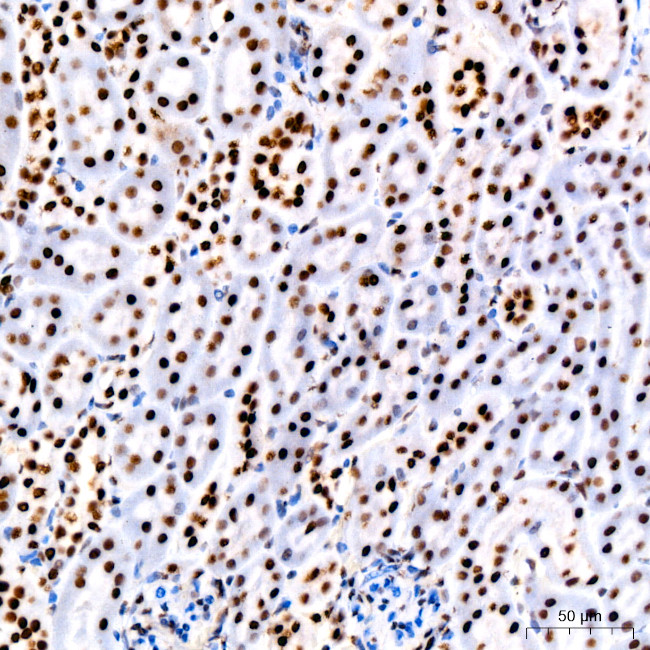 PARP1 Antibody in Immunohistochemistry (Paraffin) (IHC (P))