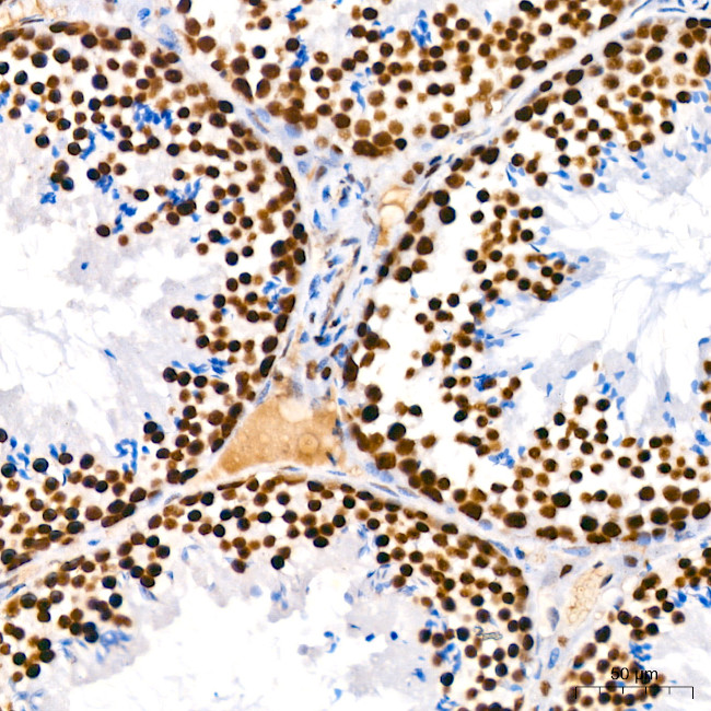 PARP1 Antibody in Immunohistochemistry (Paraffin) (IHC (P))