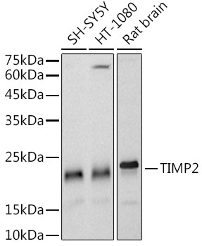 TIMP2 Antibody in Western Blot (WB)