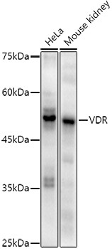 VDR Antibody in Western Blot (WB)