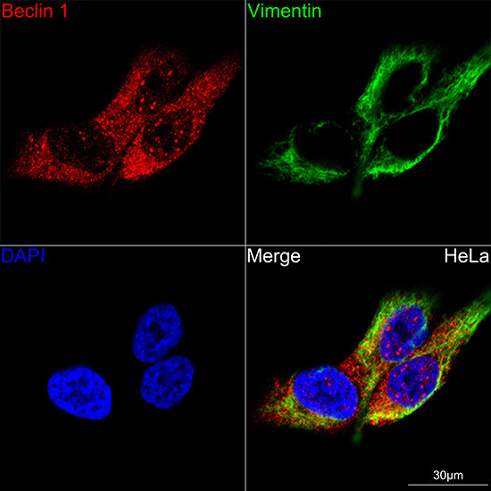 Beclin 1 Antibody in Immunocytochemistry (ICC/IF)