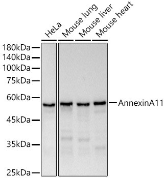 Annexin A11 Antibody in Western Blot (WB)