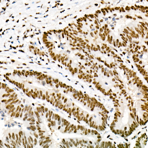 FTO Antibody in Immunohistochemistry (Paraffin) (IHC (P))