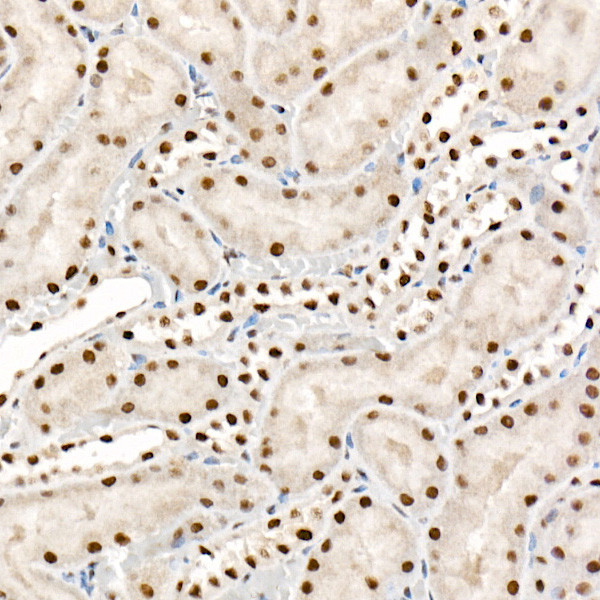 FTO Antibody in Immunohistochemistry (Paraffin) (IHC (P))