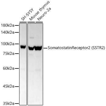 SSTR2 Antibody in Western Blot (WB)