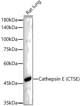 Cathepsin E Antibody in Western Blot (WB)