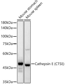 Cathepsin E Antibody in Western Blot (WB)