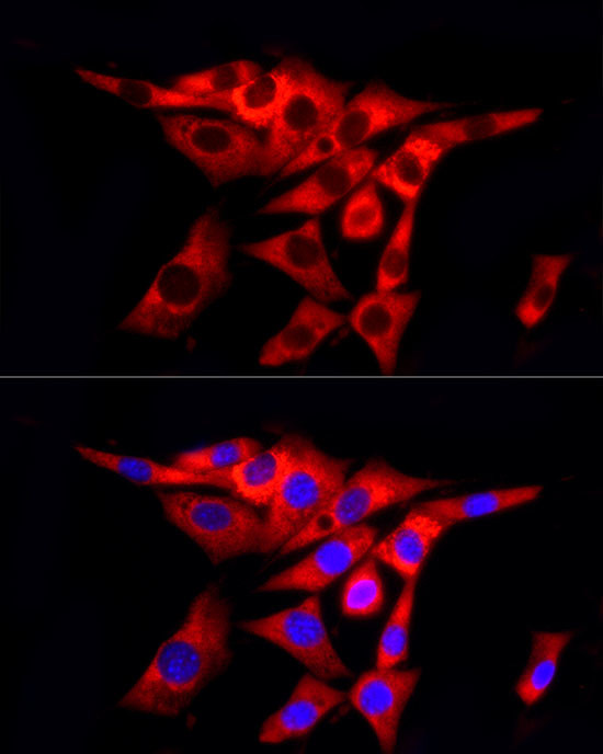 COL1A2 Antibody in Immunocytochemistry (ICC/IF)