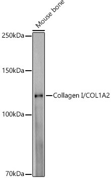 COL1A2 Antibody in Western Blot (WB)