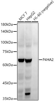 P4HA2 Antibody in Western Blot (WB)