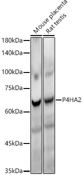 P4HA2 Antibody in Western Blot (WB)