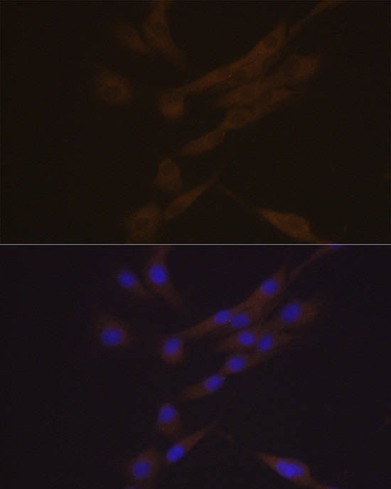 CHI3L1 Antibody in Immunocytochemistry (ICC/IF)