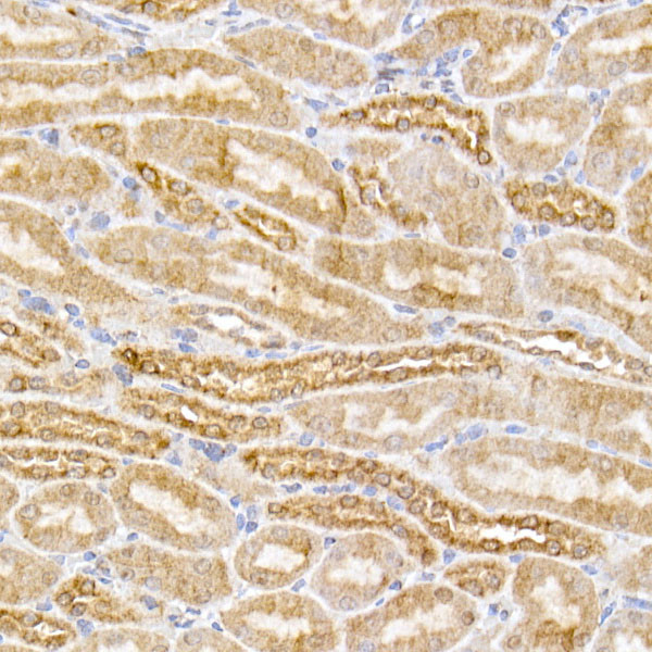 SIRT3 Antibody in Immunohistochemistry (Paraffin) (IHC (P))