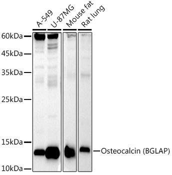 Osteocalcin Antibody in Western Blot (WB)