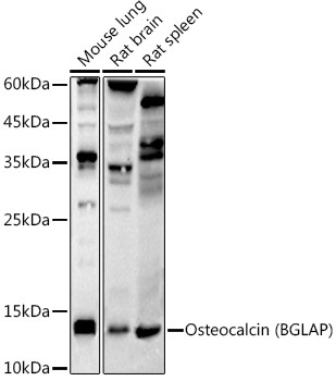 Osteocalcin Antibody in Western Blot (WB)