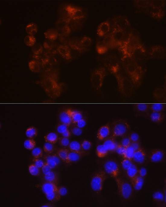 LDLR Antibody in Immunocytochemistry (ICC/IF)