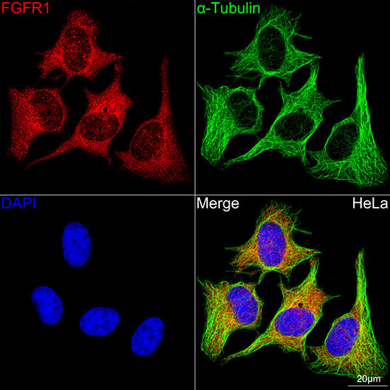 FGFR1 Antibody in Immunocytochemistry (ICC/IF)