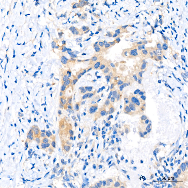 FGFR1 Antibody in Immunohistochemistry (Paraffin) (IHC (P))