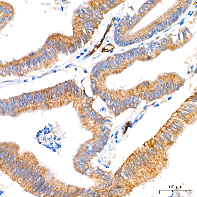 FGFR1 Antibody in Immunohistochemistry (Paraffin) (IHC (P))