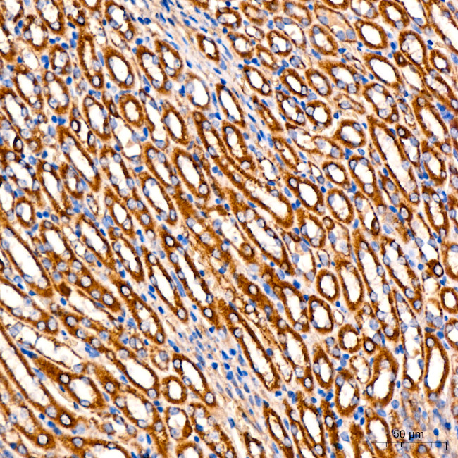 FGFR1 Antibody in Immunohistochemistry (Paraffin) (IHC (P))