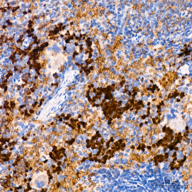 FGFR1 Antibody in Immunohistochemistry (Paraffin) (IHC (P))