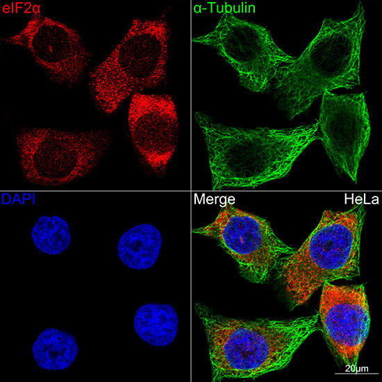 EIF2S1 Antibody in Immunocytochemistry (ICC/IF)