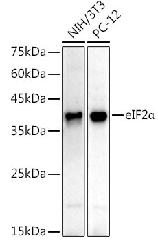 EIF2S1 Antibody in Western Blot (WB)