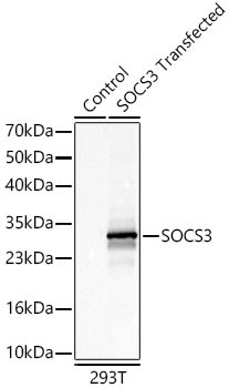 SOCS3 Antibody in Western Blot (WB)