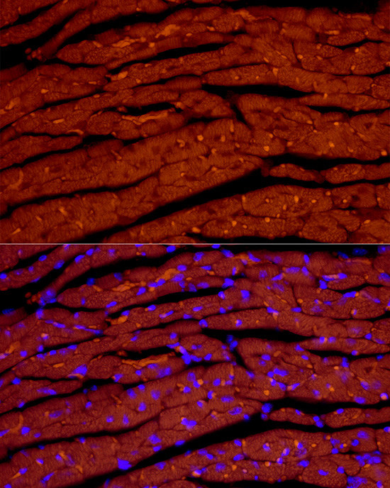 ANP Antibody in Immunocytochemistry (ICC/IF)