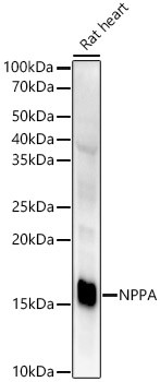 ANP Antibody in Western Blot (WB)