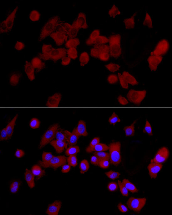 CYP3A4 Antibody in Immunocytochemistry (ICC/IF)