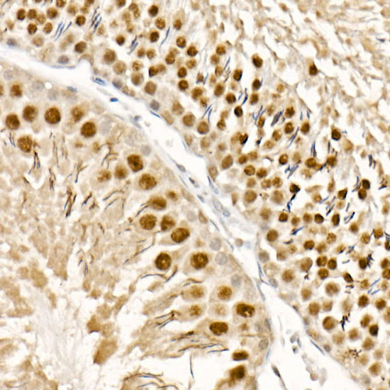 TFEB Antibody in Immunohistochemistry (Paraffin) (IHC (P))