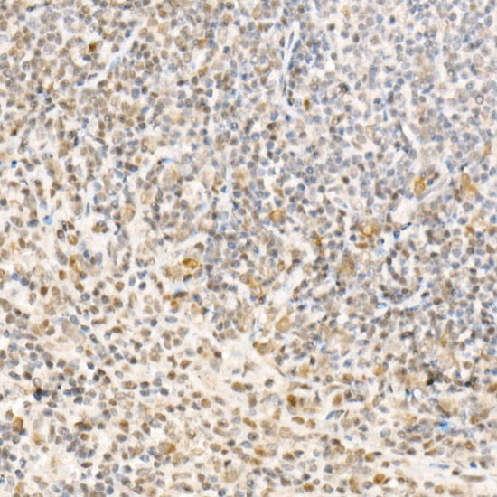 TFEB Antibody in Immunohistochemistry (Paraffin) (IHC (P))