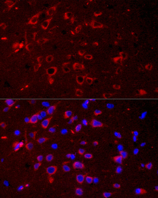 DKK3 Antibody in Immunocytochemistry (ICC/IF)