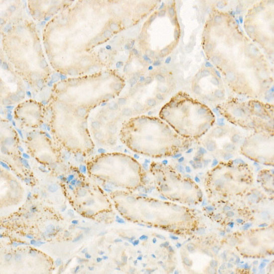 AMID Antibody in Immunohistochemistry (Paraffin) (IHC (P))