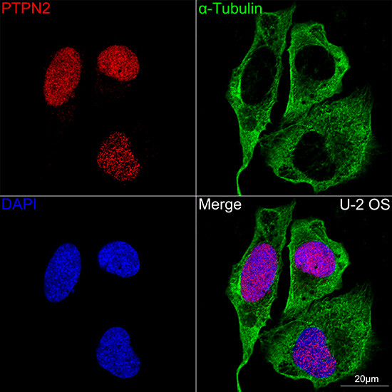 PTPN2 Antibody in Immunocytochemistry (ICC/IF)