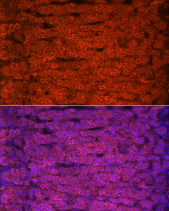 STAR Antibody in Immunocytochemistry (ICC/IF)